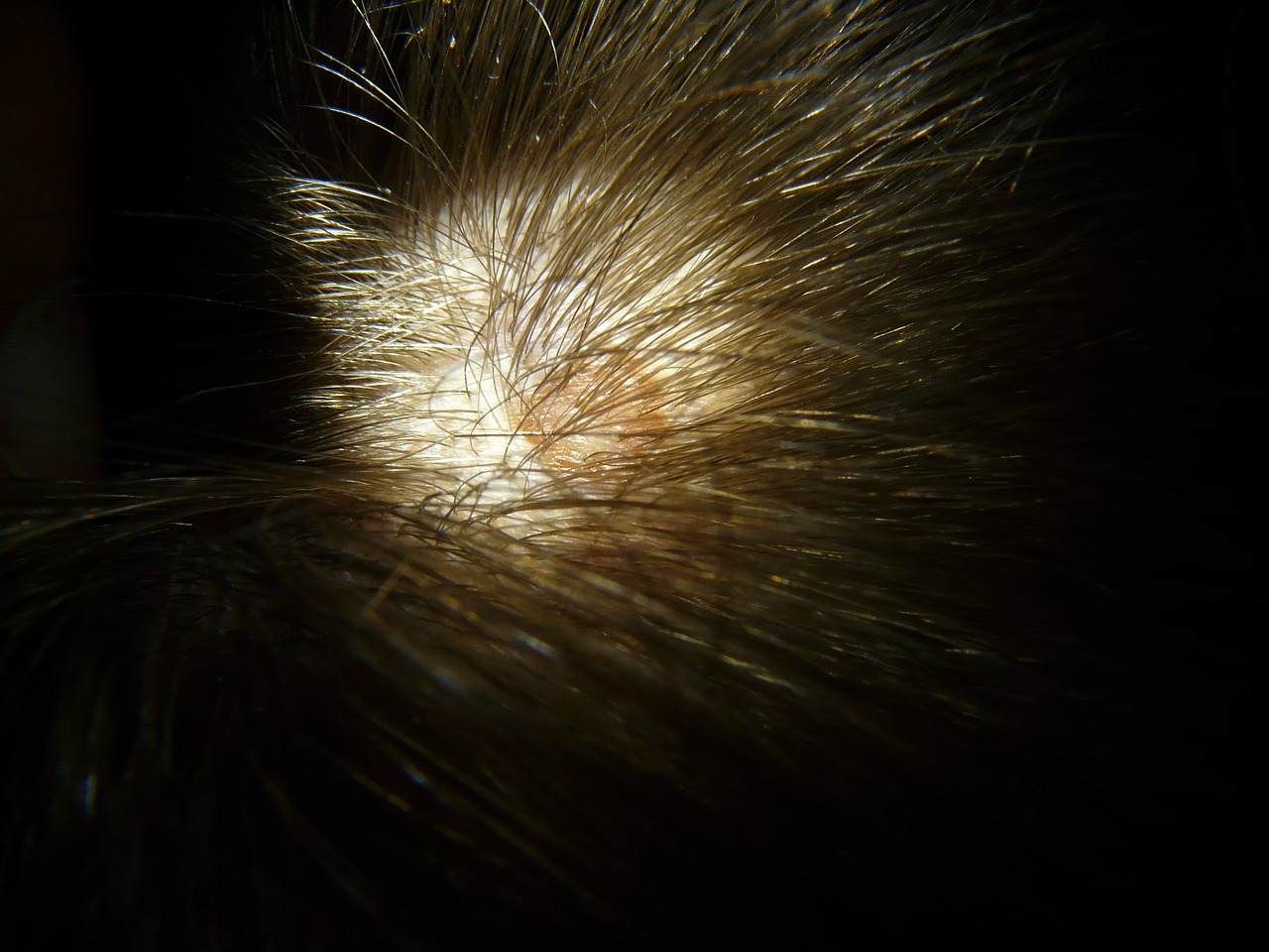 5-Things-to-Do-Before-Your-Scalp-Micropigmentation-Treatment.jpg